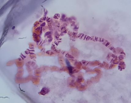 chromosom 1